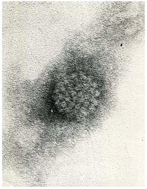 Polyoma Virus