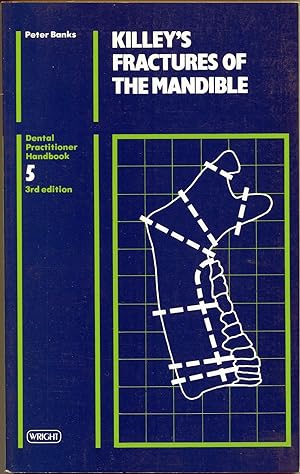 Seller image for Killey's Fractures of the Mandible for sale by The Green Arcade