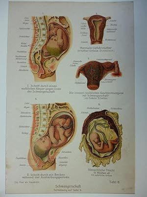 Orig. kolorierter Holzstich - Medizin - Schwangerschaft. (Fortsetzung auf Tafel 9.)