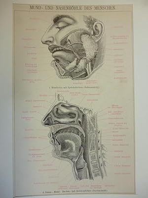 Orig. kolorierter Holzstich - HNO-Arzt - Mund- und Nasenhöhle des Menschen.