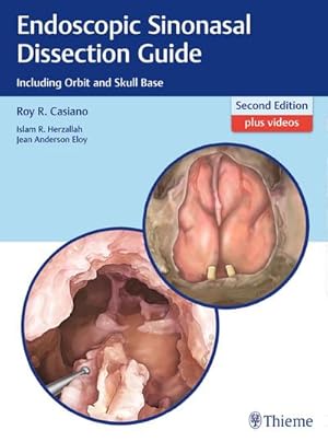 Seller image for Endoscopic Sinonasal Dissection Guide for sale by BuchWeltWeit Ludwig Meier e.K.