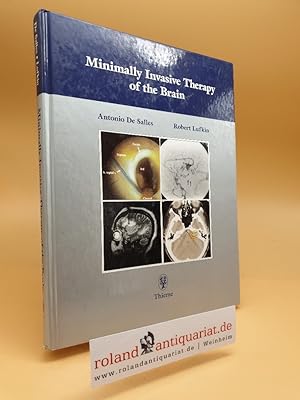 Immagine del venditore per Minimally Invasive Therapy of the Brain. ed. by Antonio A. F. DeSalles ; Robert B. Lufkin venduto da Roland Antiquariat UG haftungsbeschrnkt