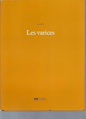 Les varices