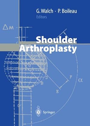 Bild des Verkufers fr Shoulder Arthroplasty zum Verkauf von AHA-BUCH GmbH
