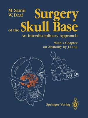 Bild des Verkufers fr Surgery of the Skull Base : An Interdisciplinary Approach zum Verkauf von AHA-BUCH GmbH