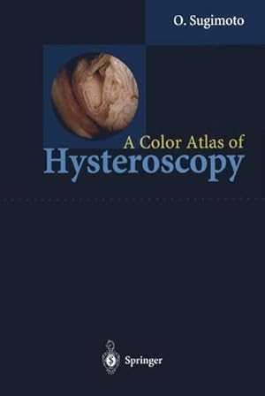 Imagen del vendedor de A Color Atlas of Hysteroscopy a la venta por AHA-BUCH GmbH
