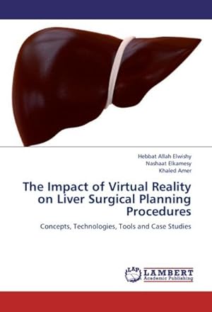 Imagen del vendedor de The Impact of Virtual Reality on Liver Surgical Planning Procedures : Concepts, Technologies, Tools and Case Studies a la venta por AHA-BUCH GmbH