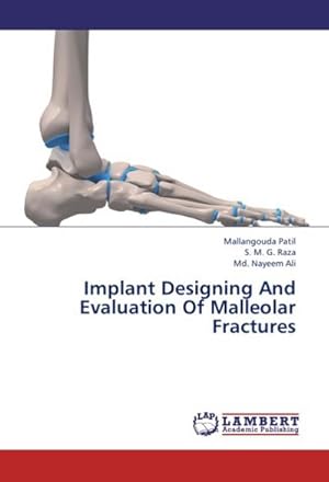 Seller image for Implant Designing And Evaluation Of Malleolar Fractures for sale by AHA-BUCH GmbH