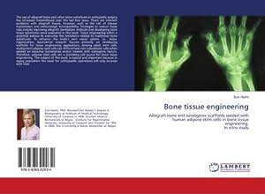 Image du vendeur pour Bone tissue engineering : Allograft bone and osteogenic scaffolds seeded with human adipose stem cells in bone tissue engineering. In vitro study mis en vente par AHA-BUCH GmbH