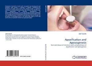 Seller image for Apexification and Apexogenesis : Root end closure of immature teeth using technique of Apexification and Apexogenesis for sale by AHA-BUCH GmbH