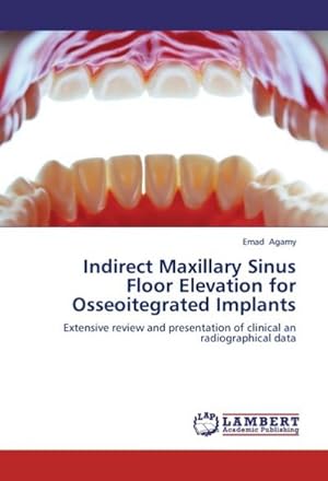 Immagine del venditore per Indirect Maxillary Sinus Floor Elevation for Osseoitegrated Implants : Extensive review and presentation of clinical an radiographical data venduto da AHA-BUCH GmbH