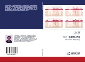 Immagine del venditore per Peri-implantitis : Unravelling the mystery venduto da AHA-BUCH GmbH