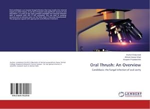 Imagen del vendedor de Oral Thrush: An Overview : Candidiasis: the fungal infection of oral cavity a la venta por AHA-BUCH GmbH