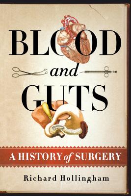 Image du vendeur pour Blood and Guts: A History of Surgery (Paperback or Softback) mis en vente par BargainBookStores