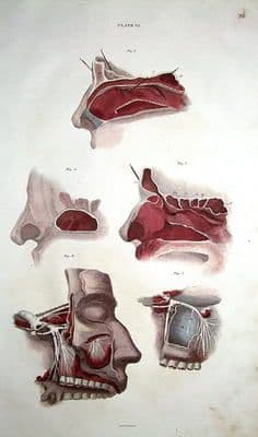 NOSE & SUPERIOR MAXILLARY NERVE Lizars Original Antique Anatomy Print c 1825