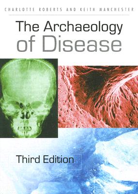 Immagine del venditore per The Archaeology of Disease (Paperback or Softback) venduto da BargainBookStores