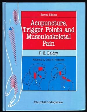 Acupuncture, Trigger Points and Musculoskeletal Pain: A Scientific Approach to Acupuncture (Secon...