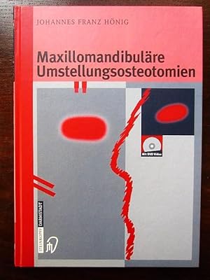 Immagine del venditore per Maxillomandibulre Umstellungsosteotomien venduto da Rudi Euchler Buchhandlung & Antiquariat