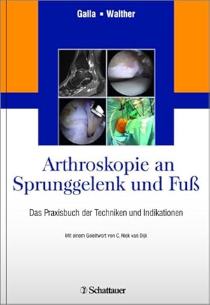 Arthroskopie an Sprunggelenk und Fuß Das Praxisbuch der Techniken und Indikationen