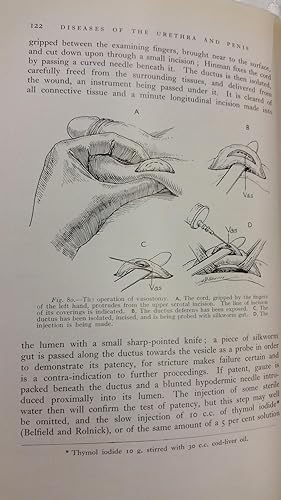 Image du vendeur pour Diseases of the Urethra and Penis mis en vente par Lola's Antiques & Olde Books