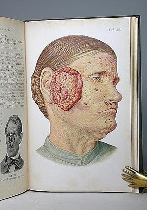 Grundriß und Atlas der allgemeinen Chirurgie. Zweite vermehrte und verbesserte Auflage. (Lehmanns...