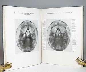 Imagen del vendedor de Die Rntgendarstellung des Gesichtsschdels. Mit 229 Abbildungen. a la venta por Librarium of The Hague