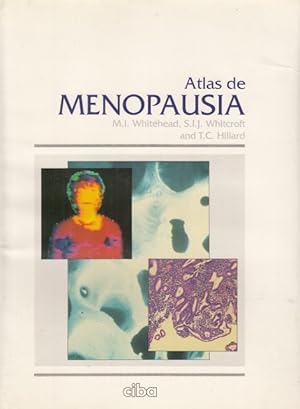 Seller image for Atlas de Menopausia for sale by Librera Vobiscum