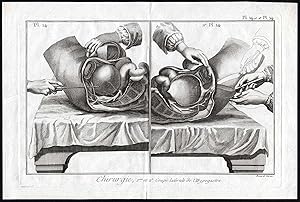 Antique Print-SURGERY-MEDICAL-HYPOGASTRIUM-CROSS SECTION-Diderot-Benard-1779