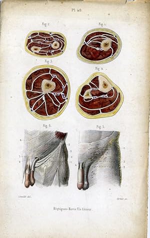 Antique Print-MEDICAL-LEG-ARM-MUSCLES-Masse-1843