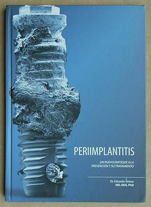 Periimplantitis: Un nuevo enfoque a la prevención y su tratamiento