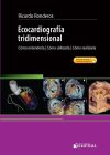 Ecocardiografía Tridimensional. : cómo entenderla, cómo utilizarla, cómo realizarla