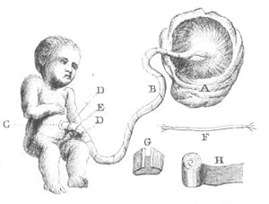 Bild des Verkufers fr L'ostetrica; ovvero, L'arte di raccogliere i parti e di soccorre le donne nelle malatte, che accompagnano la loro gravidanza, ed in quelle che soppravvengono loro dopo il parto; e di sollevare i bambini nelle loro maltte dopo la nascita zum Verkauf von Martayan Lan