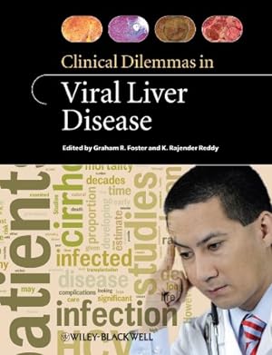 Seller image for Clinical Dilemmas in Viral Liver Disease for sale by Libro Co. Italia Srl