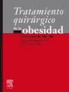 Tratamiento quirúrgico de la obesidad