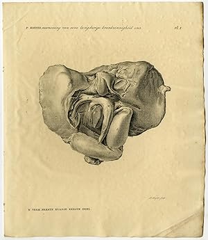 Antique Print-HUMAN ANATOMY-INSANITY-WORMS-LIVER-INTENTESTINS-Koning-Sluyter-1827