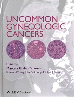 Immagine del venditore per Uncommon Gynecologic Cancers venduto da GreatBookPrices
