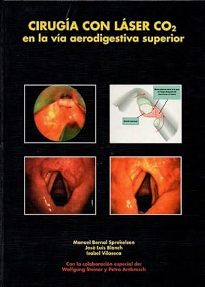 Imagen del vendedor de CIRUGIA CON LASER CO2 EN LA VIA AERODIGESTIVA SUPERIOR. a la venta por Librera DANTE
