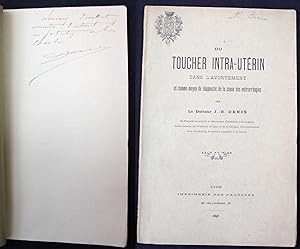 Du Toucher Intra-Uterin dans l'Avortement et comme moyen de diagnostic de la cause des metrorrhagies