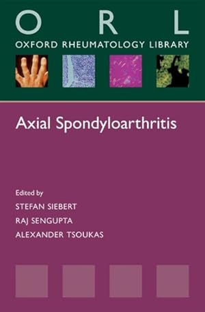 Seller image for Axial Spondyloarthritis for sale by GreatBookPrices