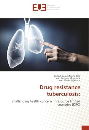 Seller image for Drug resistance tuberculosis: : challenging health concern in resource limited countries (DRC) for sale by AHA-BUCH GmbH