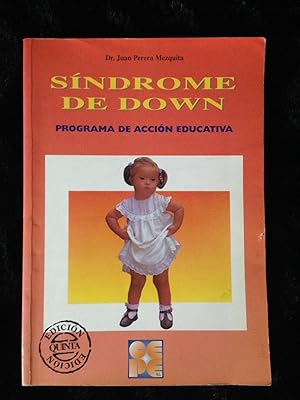 SINDROME DE DOWN :Programa de acción educativa