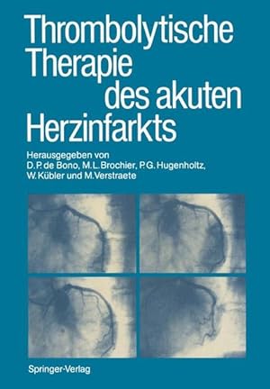 Seller image for Thrombolytische Therapie des akuten Herzinfarkts (German Edition) for sale by Antiquariat Armebooks