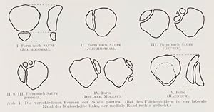 Seller image for Die Patella partita (pp.1-53, 37 Abb.). for sale by Antiq. F.-D. Shn - Medicusbooks.Com