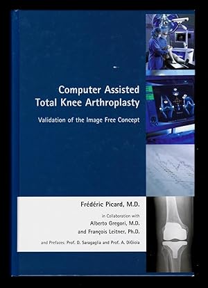 Seller image for Computer Assisted Orthopaedics: The Image Free Concept in Total Knee Arthroplasty (Validation of the Image Free Concept) for sale by killarneybooks