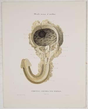 Bild des Verkufers fr Museum anatomicum Holmiense : quod auspiciis Oscaris Primiediderunt professores regiae scholae medico-chirurgicae Carolinensis ; Sectio pathologia. Fasiculis I, Continens Casus X cum XII Tabulis (all publ.). zum Verkauf von Antiq. F.-D. Shn - Medicusbooks.Com