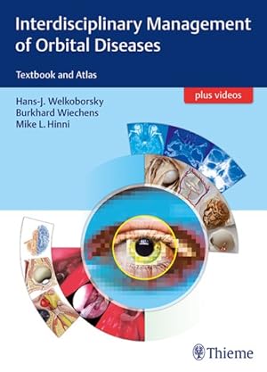 Seller image for Interdisciplinary Management of Orbital Diseases : Textbook and Atlas for sale by GreatBookPrices