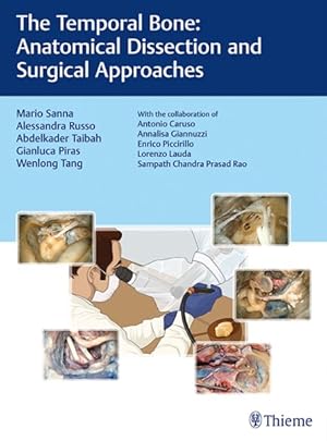 Image du vendeur pour Temporal Bone : Anatomical Dissection and Surgical Approaches mis en vente par GreatBookPrices
