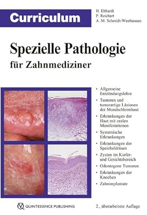 Bild des Verkufers fr Curriculum Spezielle Pathologie fr Zahnmediziner zum Verkauf von AHA-BUCH GmbH