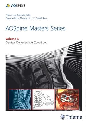 Bild des Verkufers fr Aospine Masters Series Volume 3: Cervical Degenerative Conditions zum Verkauf von AHA-BUCH GmbH