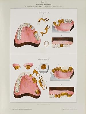 Atlas und Lehrbuch meiner Systeme der modernen zahnärztlichen Metalltechnik.